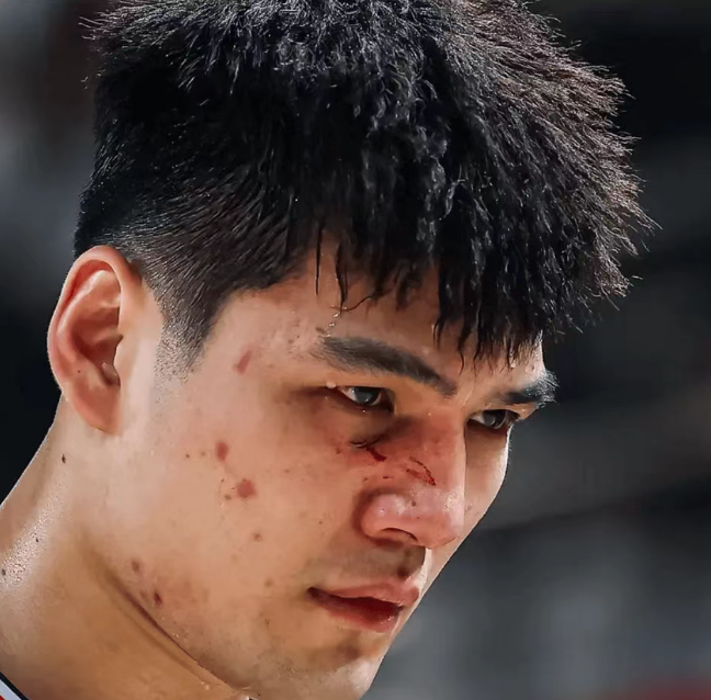 伤痕明显！广州状元陈国豪面部骨裂 季后赛大概率戴面具对阵广东 | 中国区|球友会|股份有限公司